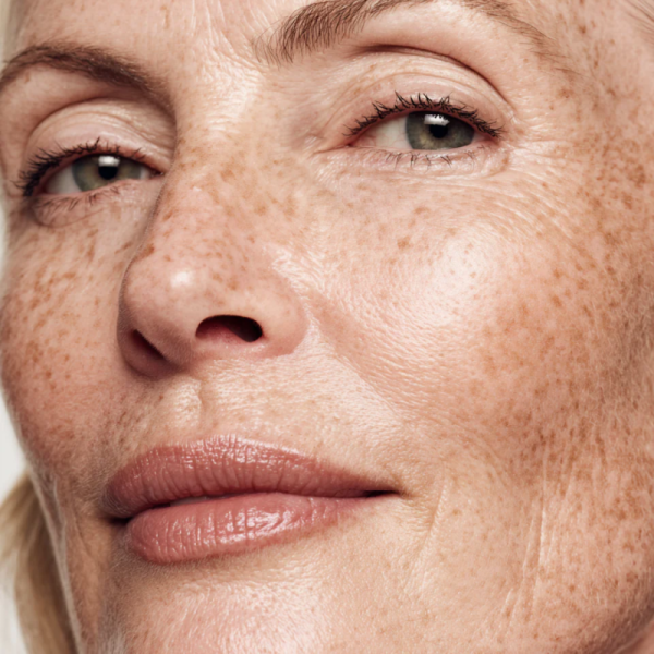 Pelle secca in menopausa: perché compare e come restituirle idratazione